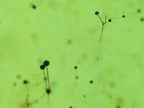 顯微鏡下的面包霉