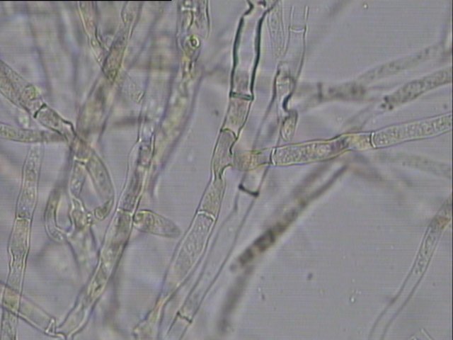 顯微鏡辨別真菌
